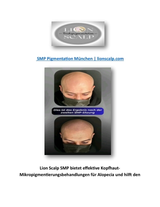 SMP Pigmentation München | lionscalp.com