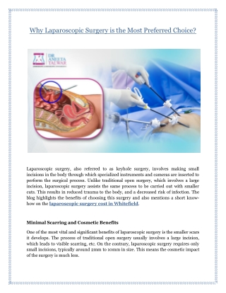 Why Laparoscopic Surgery is the Most Preferred Choice?