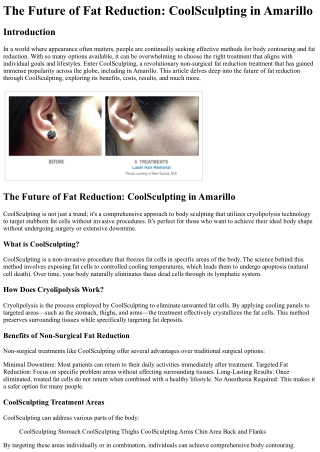 The Future of Fat Reduction CoolSculpting in Amarillo