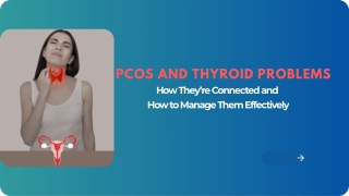 PCOS and Thyroid Problems How They’re Connected and How to Manage Them Effectively