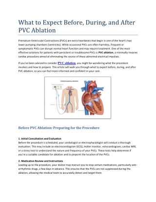 What to Expect Before, During, and After PVC Ablation