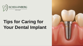Essential Guide Dental Implant Maintenance Tips for Long-Term Success