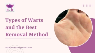 types of warts and the best removal method