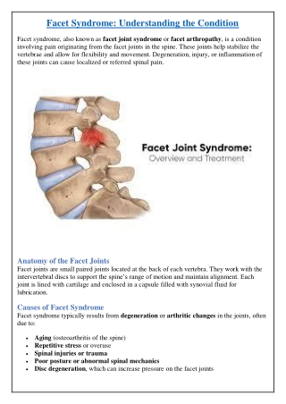 facet syndrome understanding the condition