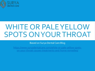 white or pale yellow spots on your throat