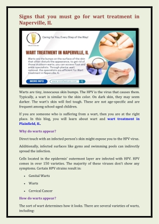 wart treatment in Naperville, IL