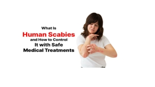 What Is Human Scabies and How to Control It with Safe Medical Treatments