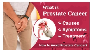 Understanding Prostate Cancer In Men’s Life: A Guide for Men