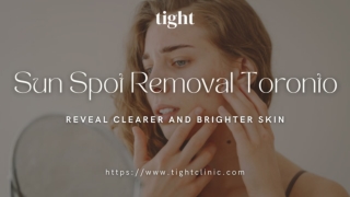 Sun Spot Removal Toronto Using Advanced Laser Treatment