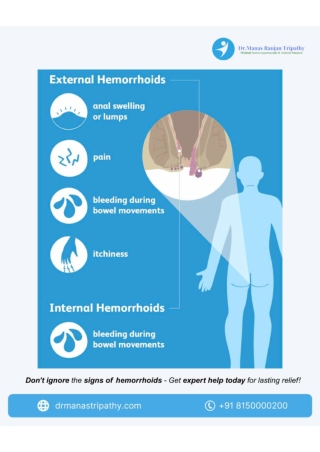 Don’t Ignore Hemorrhoids! Know the Signs and Get Treated  Dr. Manas Ranjan Tripathy_Proctologist in HSR Layout (1)